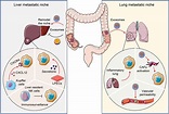 Frontiers | Tumor Microenvironment Shapes Colorectal Cancer Progression ...