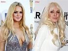 Lindsay Lohan Lip Injections Surgery Before And After Augmentation Photos