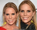Cheryl Hines Plastic Surgery Comparison Photos