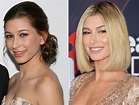 Hailey Baldwin Before and After Plastic Surgery