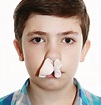 What You Need to Know about Nosebleeds (Epistaxis) - Facty Health