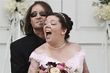 USA: Sie heiratete ihn mit dem Gesicht eines Toten - WELT