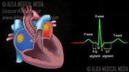 不同医疗设备呈现的真实心脏跳动 （慎点）