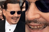 All About Johnny Depp's Teeth | THE DENTAL DISTRICT