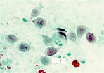 Giardia Lamblia Cyst Under Microscope - Micropedia