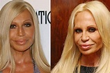 ¡Abusó de las cirugías! El antes y después de Donatella Versace | Nueva ...