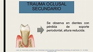 TRAUMA OCLUSAL. “Trauma en el periodonto de fuerzas funcionales o para ...