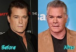 Ray Liotta Plastic Surgery: Shock And Surprise For Fans
