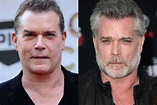 Ray Liotta Plastic Surgery: Facelift, Botox, Hair Transplant