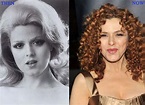 Bernadette Peters Plastic Surgery Photo Before and After - CELEB ...