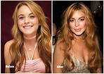Lindsay Lohan Plastic Surgery Before and After Photo 2013-2014