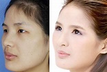 複数の女性の整形前後の比較写真がネットに登場_中国網_日本語