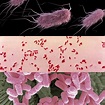 Escherichia coli - jcarrbiomed.com : 365 Days of Microscopy