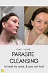 Acne Update & My Parasite Cleanse Experience | Painful acne, Parasite ...