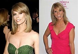Cheryl Hines Plastic Surgery Before And After Pictures | 2018 Plastic ...