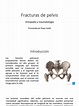 Fracturas de Pelvis | PDF | Pelvis | Sistema musculoesquelético