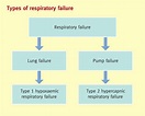 Respiratory failure - Medicine