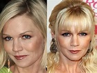 Jennie Garth Plastic Surgery Before and After Botox Injections | Celebie