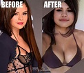 Selena Gomez Plastic Surgery Revealed! Before and After 2019