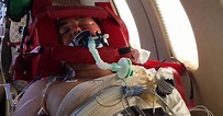 Plane crash victim survives horrific burns, vows to create change