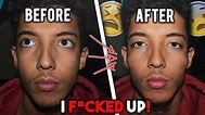 I SMASHED MY CHEEK BONES FOR A WEEK *GONE WRONG* - YouTube