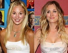 Kaley Cuoco admits nose plastic surgery and breast implants!