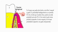 Surco Gingival Periodoncia I-Darmari Valdez - YouTube