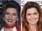 Shania Twain before and after plastic surgery (22) – Celebrity plastic ...