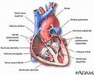 Soplo cardiaco - EcuRed