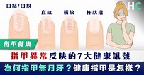 【指甲健康】指甲異常反映的7大健康訊號 健康指甲是怎樣？