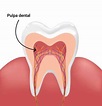 Pulpa dental: características y funciones | Adeslas Dental
