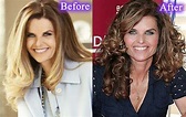 Maria Shriver Plastic Surgery Before And After Photos - CelebLens.Com