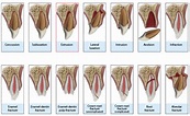 Traumatic Dental Injuries - Dr. Yehuda J. Benjamin, DMD, FAGD, MS ...