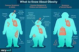 Obesity Symptoms for Adults and Children