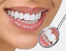 Protect Your Smile - 6 Teeth Whitening Remedies You Should Consider ...