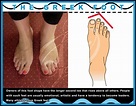 9 FOOT SHAPES - THE GREEK FOOT | Greek feet, Skin pores, New astrology