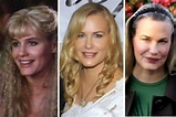 Daryl Hannah Plastic Surgery Gone Wrong Before and After Photos