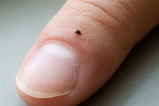 Ticks - Tickborne Disease - Minnesota Dept. of Health (2022)