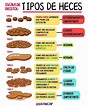 Bristol stool chart overview – Artofit