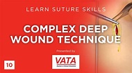 Complex Deep Wound Technique - Learn Suture Skills - VATA - YouTube