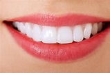 Teeth Whitening: How to Get White Teeth? | WHO Magazine