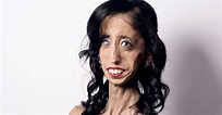 How Being Called The 'World's Ugliest Woman' Transformed Her Life ...