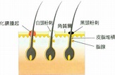 17i/10:Acne 青春痘 - 經絡學 acupuncture points - udn部落格