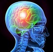 Some Men More Likely to Become Traumatic Brain Injury Victims