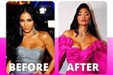 Nicole Scherzinger's plastic surgery - Before and after photos