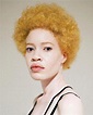 Albino African Model