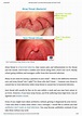 PPT - Ultimate Guide To Combat Warning Signs Of Strep Throat PowerPoint ...