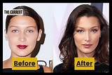 Bella Hadid Before And After Pictures: The Model's And Social Media ...