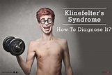 Klinefelter's Syndrome - How To Diagnose It? - By Dr. Ravindra B Kute ...