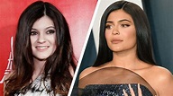Kylie Jenner Plastic Surgery Journey - Vanity